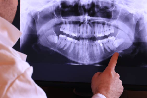 Best Emergency Treatment for Jaw Pain or Injury in Coulee Dam, WA