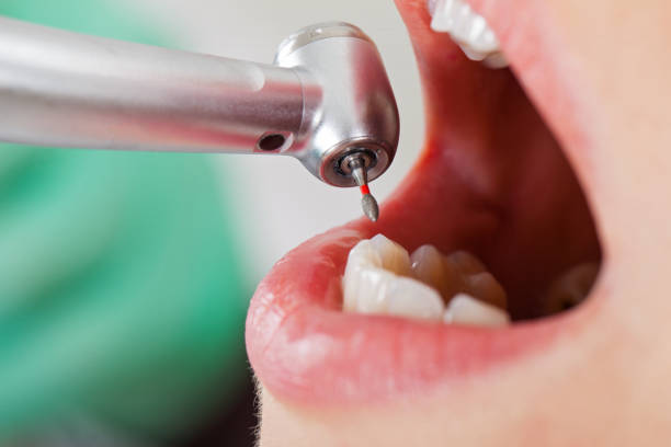 Best Dental Abscess Treatment in Coulee Dam, WA